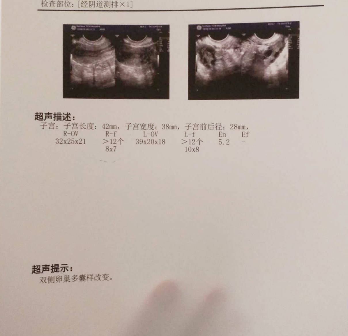 中药怎么调理多囊 815a53350b67458bbda89573c6c18375.jpeg