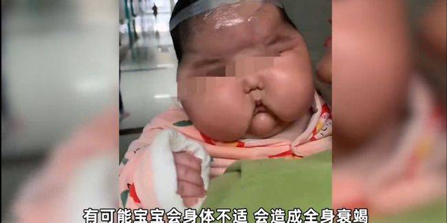 这款宝宝霜被曝有激素导致3月龄宝宝变大头娃娃赶紧自查