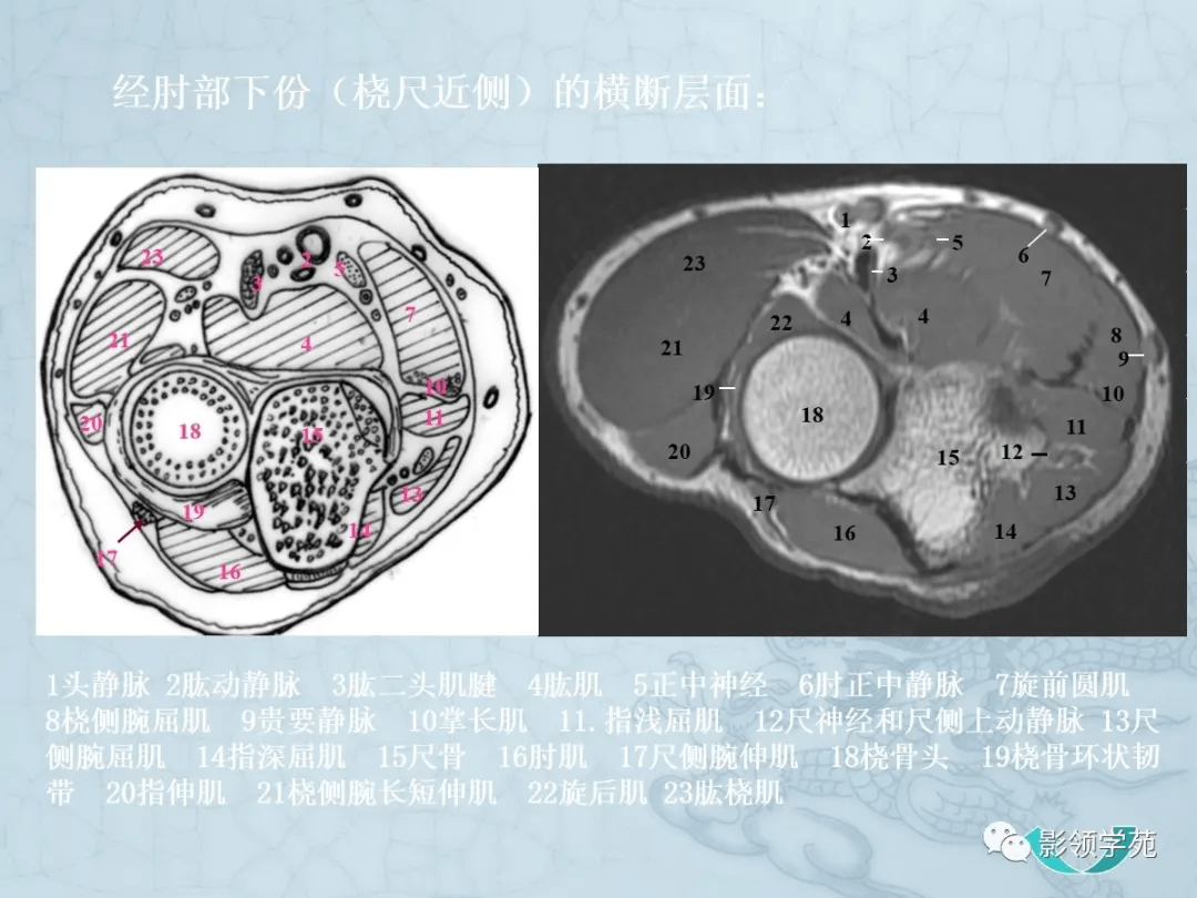 四肢断面解剖及影像