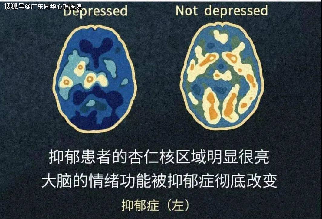 黄晓明自曝曾患抑郁症:每个人身上,都藏着一根抑郁的导火索