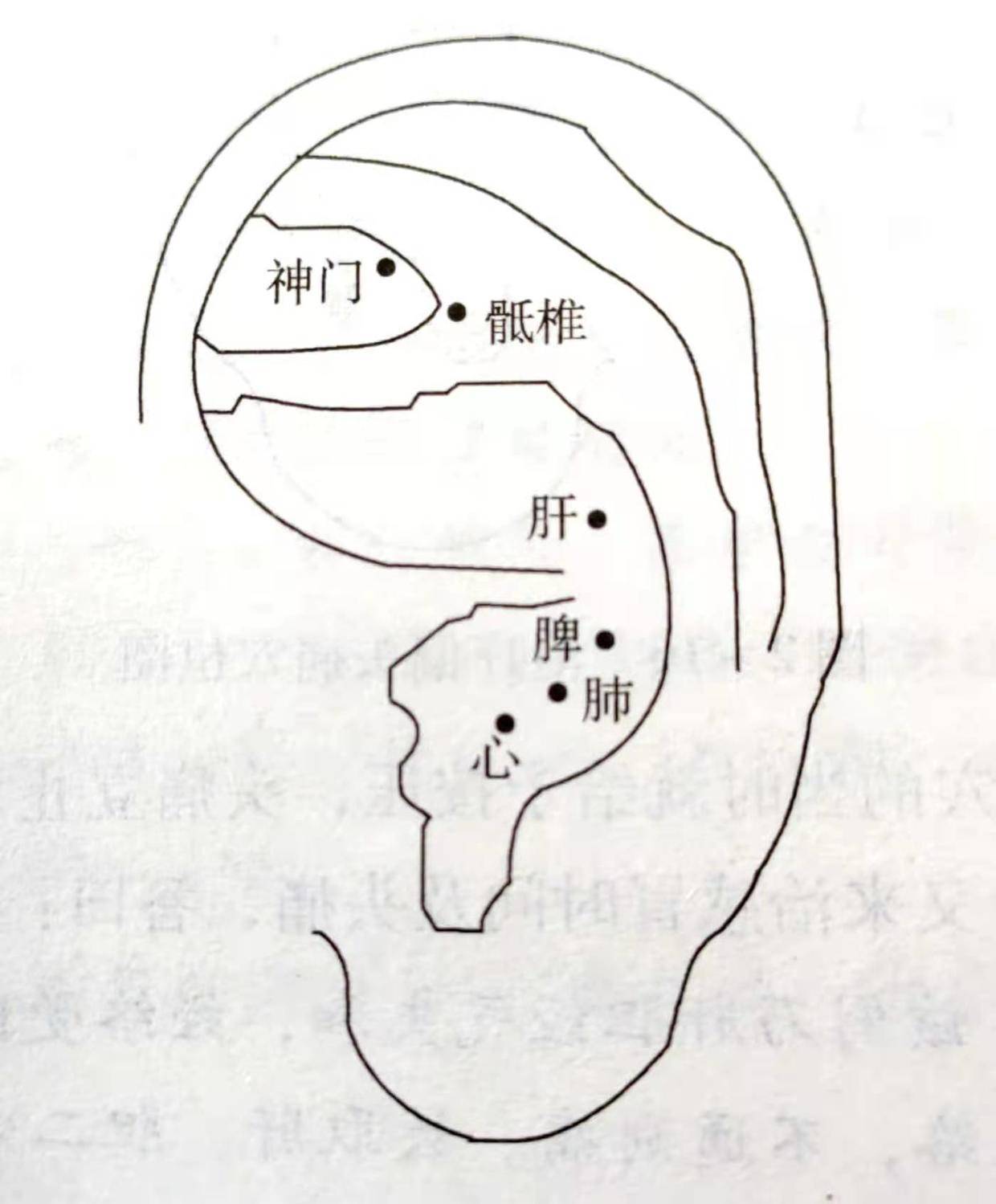 【治疗】取耳穴:骶椎,神门,心,肺,脾,肝(如图).