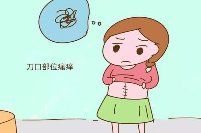 云开app官方：
宝妈照顾护士：剖腹产后刀口痒 怎么办呢？(图2)