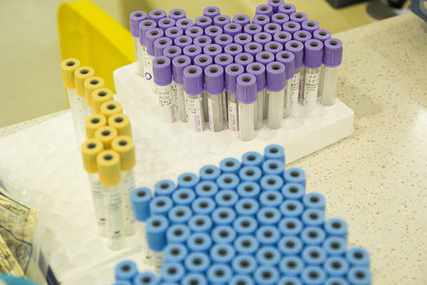 癌胚抗原多少值为正常 336fce4d9b1a4a9ca2fefe33d2601196.jpeg