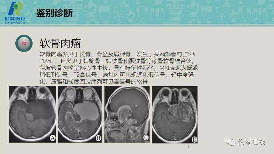 大咖读片丨上海曙光医院詹松华教授分享蝶鞍病变诊断思路