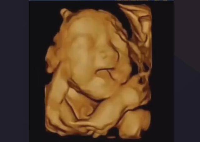 原创怀孕五个月的胎儿有多大,孕妈肚子有多大,注意些啥?孕妈收藏
