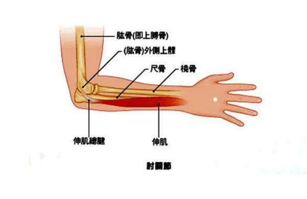 骨科医生掰手腕骨折给自己开药!网友:掰手腕还能掰骨折了?