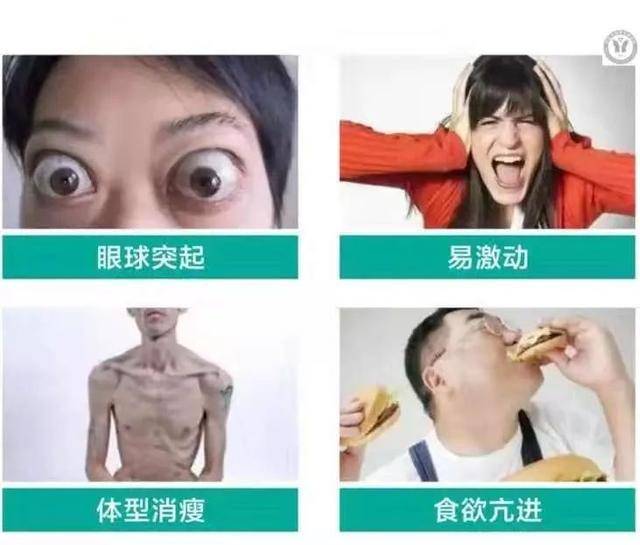 大脖子病就是甲亢吗?