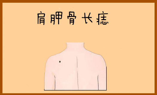 肩胛骨长痣在相学当中,若是一个人的肩胛骨的位置处长有吉痣,尤其是痣