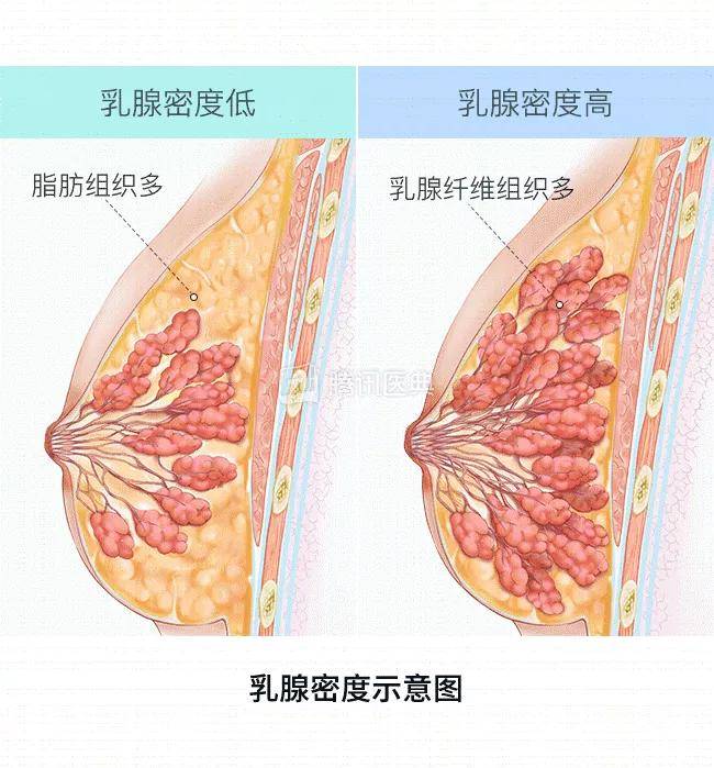 胸大的女孩子真的容易受到乳腺癌的青睐吗?快来了解一