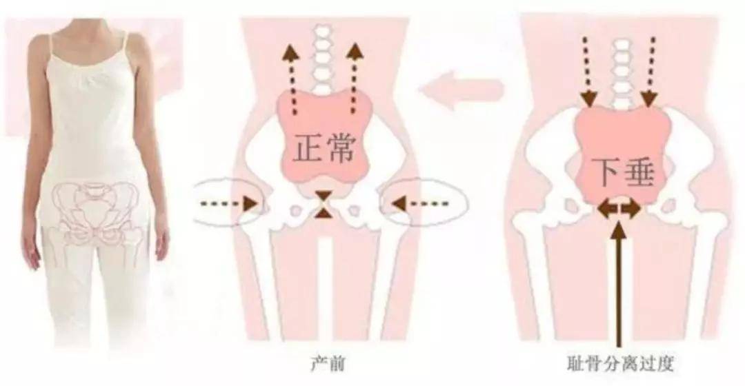 不要等到内脏下垂,漏尿憋不住,腿部变形,大屁股的时候才后悔莫及!