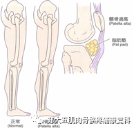 膝关节检查