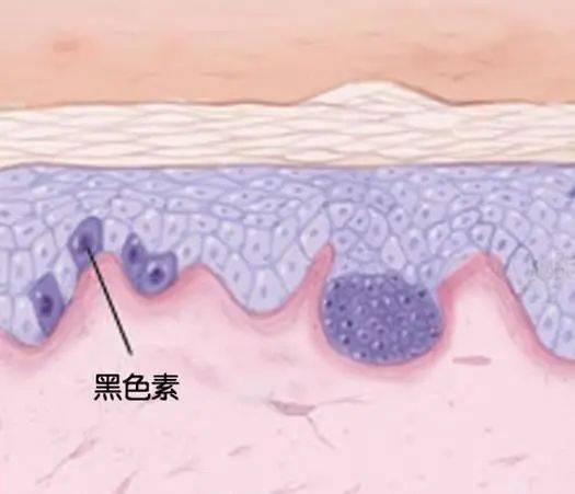 衰老帮凶黑色素究竟是有多可怕