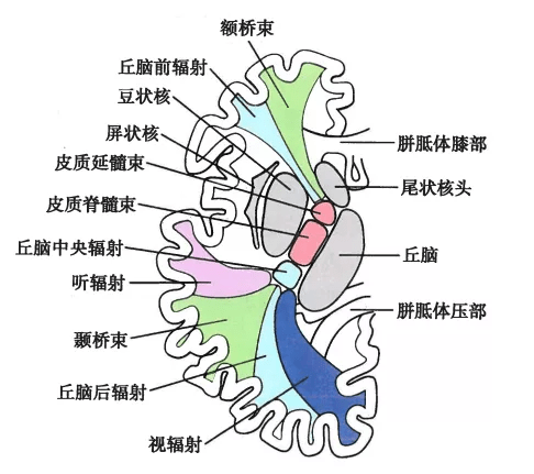 完全性内囊损害 内囊聚集了大量的上下行传导束,特别是锥体束在此高度