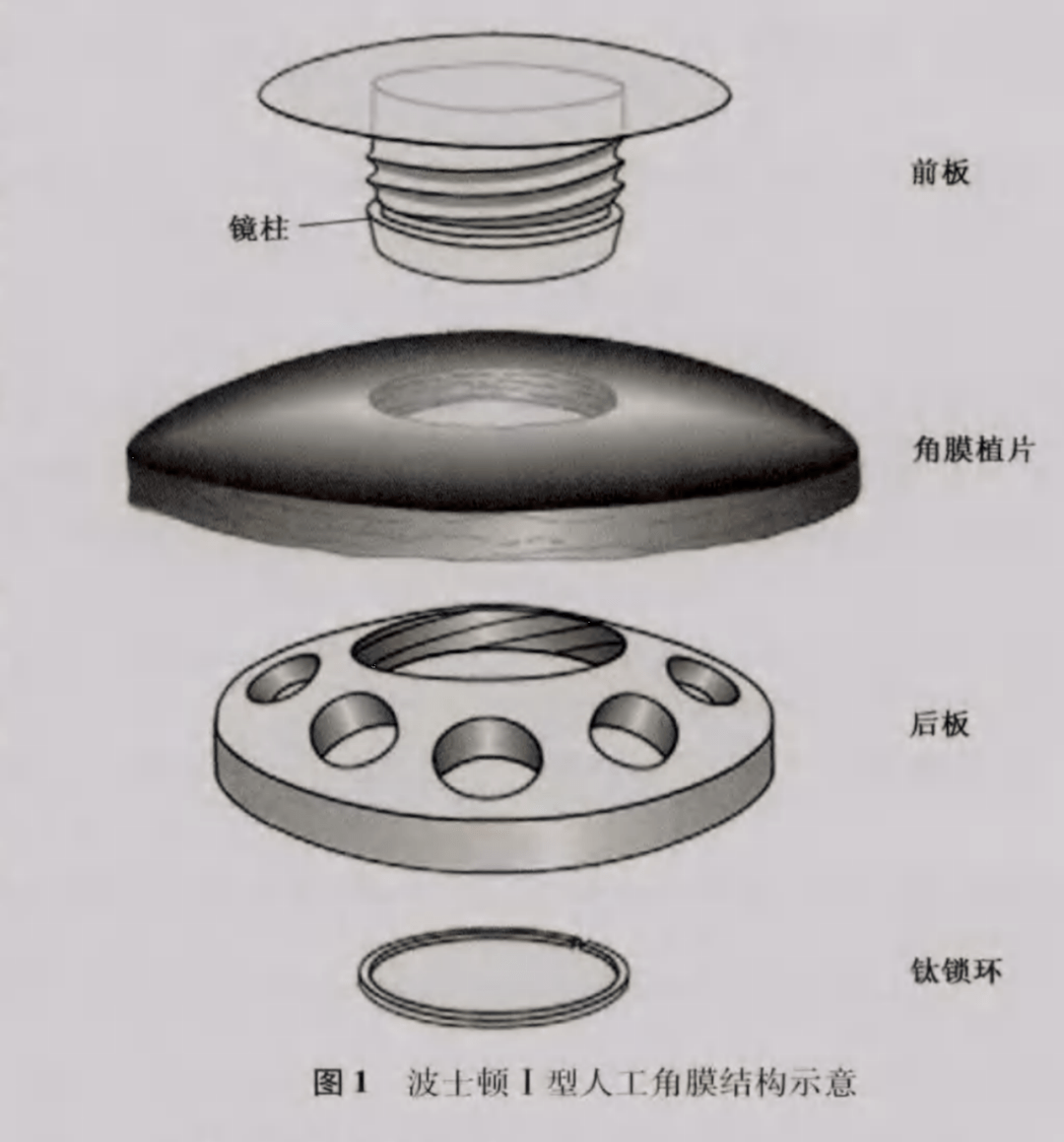 爱眼护眼16人工角膜的前世今生