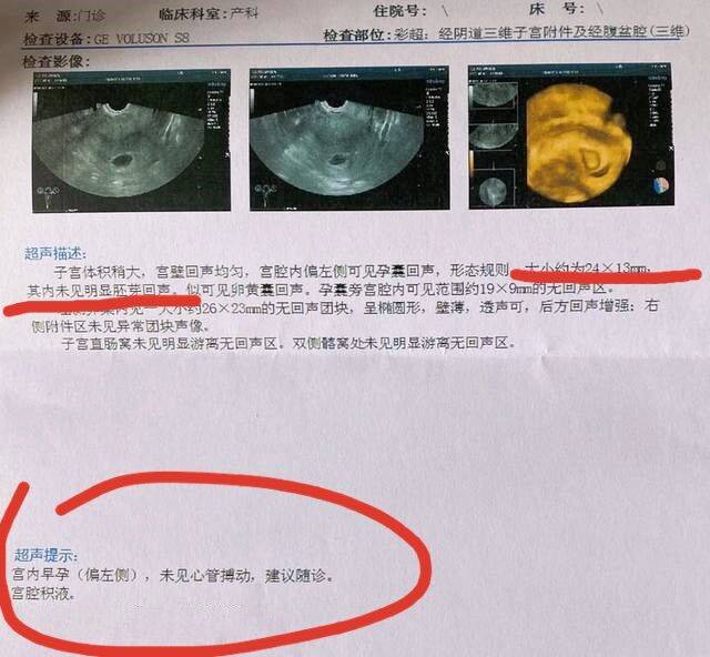 想再次怀孕,一般休息3-4个月之后就可以再次尝试怀孕了. 责任编辑