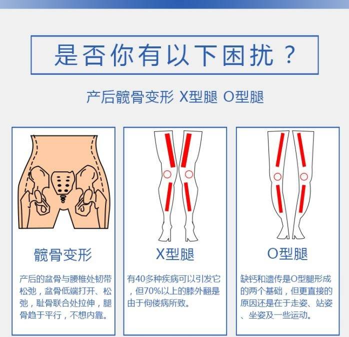 产后盆骨是否变形,自测判断