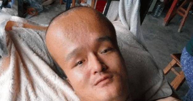原创当初因为喝了三鹿奶粉,变成大头娃娃的小孩,现在怎么样了?