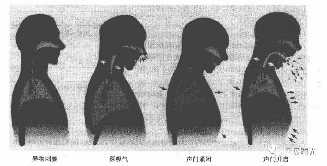 【张教授谈呼吸】如何在家中有效地咳嗽排痰?