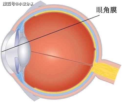 以上基本都属于角膜炎的基本症状,严重时还可能并发虹膜睫状体炎