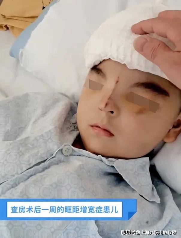 原创九院韦敏丨眶距增宽症患者危险期恢复良好,只要注意这些细节就可