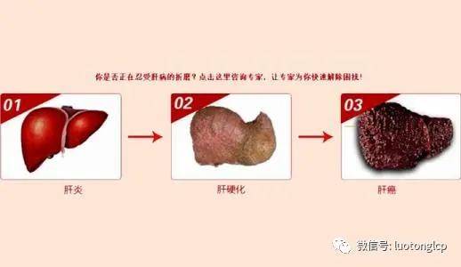 肝癌有哪些异常症状?