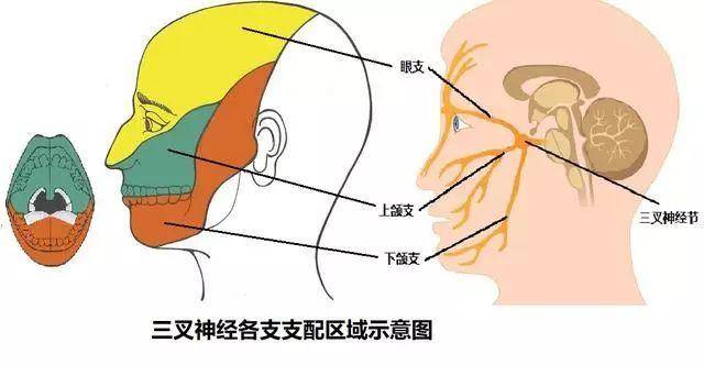 疼起来像牙痛,却又比牙痛更要命的"三叉神经痛"到底是