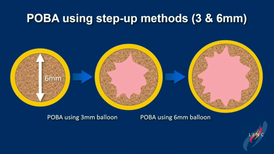 sincos教授的《subintimal recanalisation of peripheral occlusive