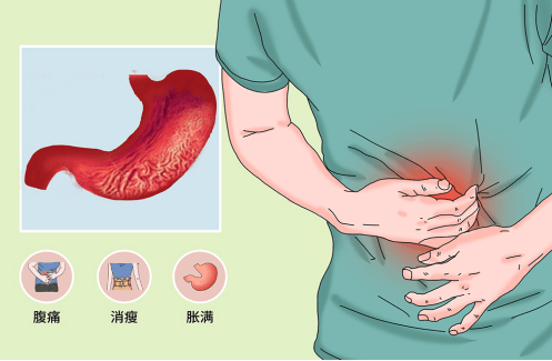 我只是胃不舒服,你说我是得了萎缩性胃炎?