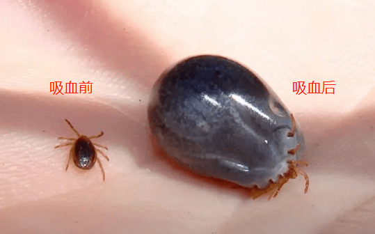 警惕!2岁娃被虫咬生命垂危,带孩子去这地方就是害他!
