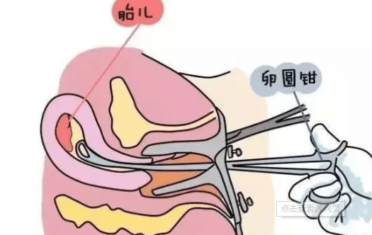 人流后子宫内膜薄多久能治好