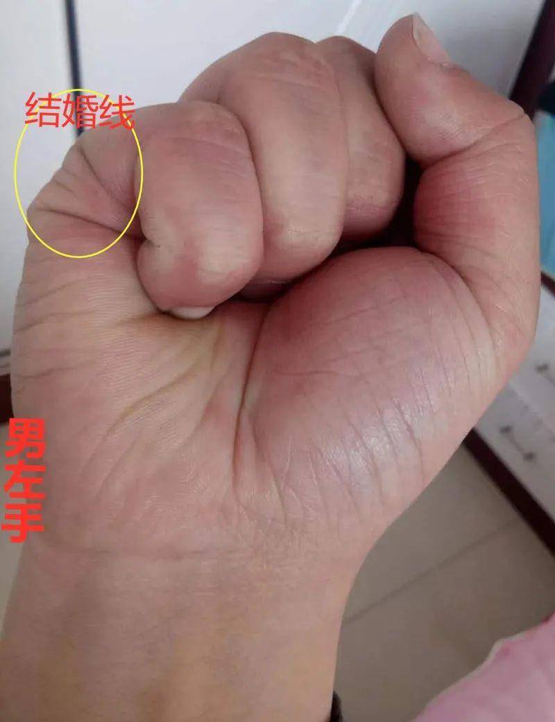 右手元宝纹明显,暗示福主经过后天不断地努力打拼,会获得财富,理财