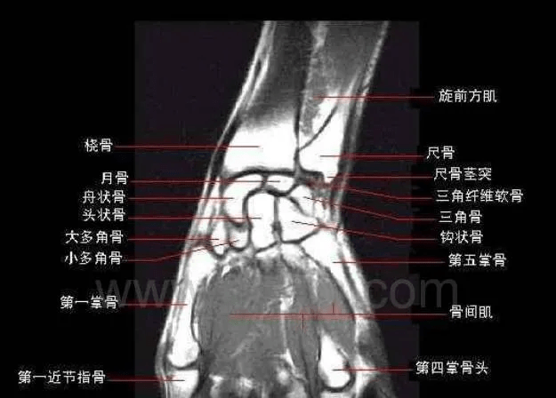 高清腕关节解剖