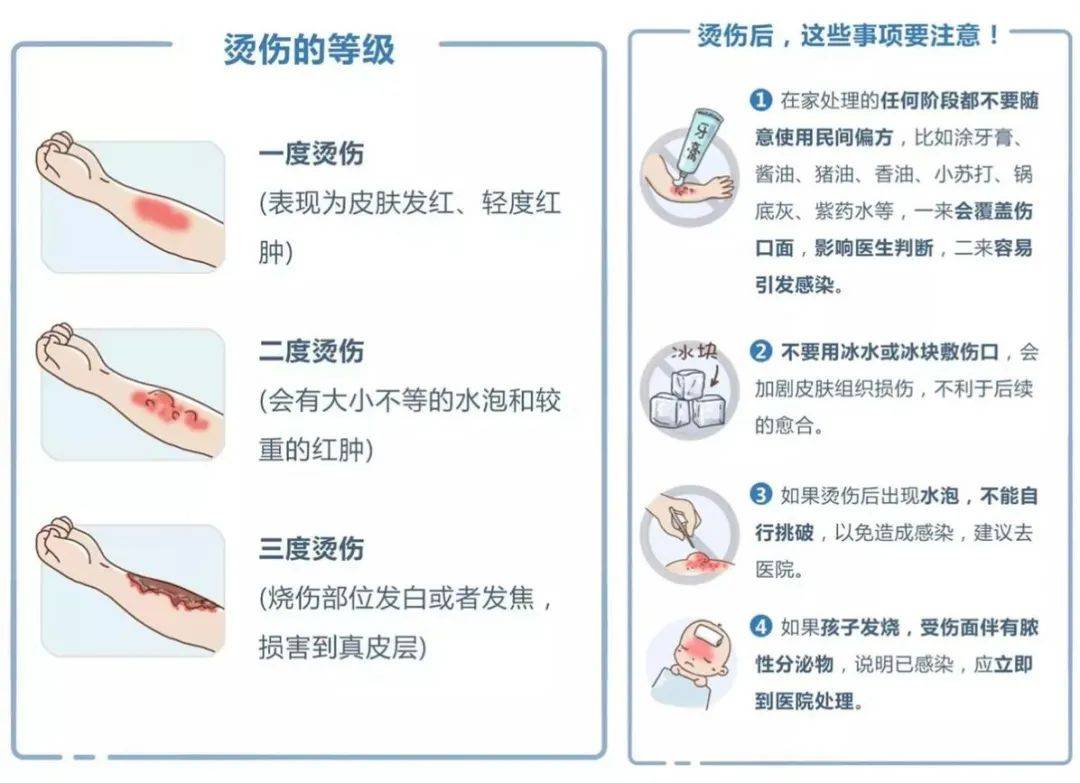 孩子被烫伤处理不对无疑是"雪上加霜",急救措施奉上,家长收好