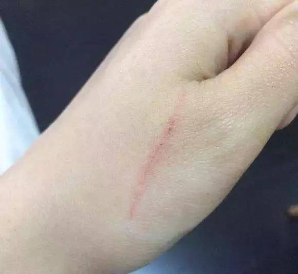 福懋动物医院:被猫抓伤要不要打狂犬疫苗?