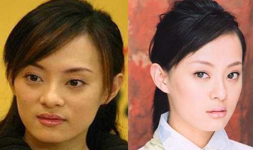 欧美女明星整容前后,好莱坞女星最爱增厚上嘴唇,没整的时候是真女神