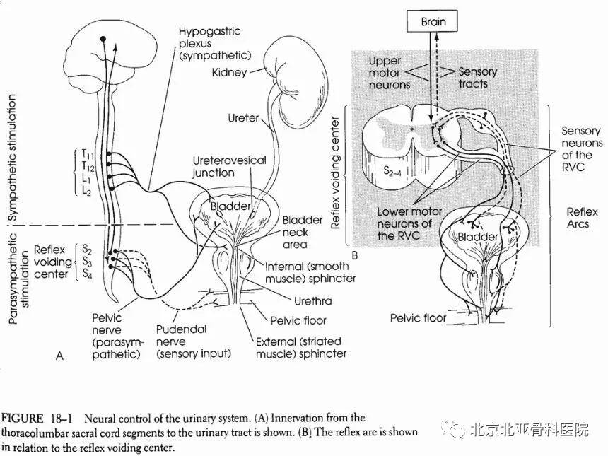 神经源性膀胱示意图