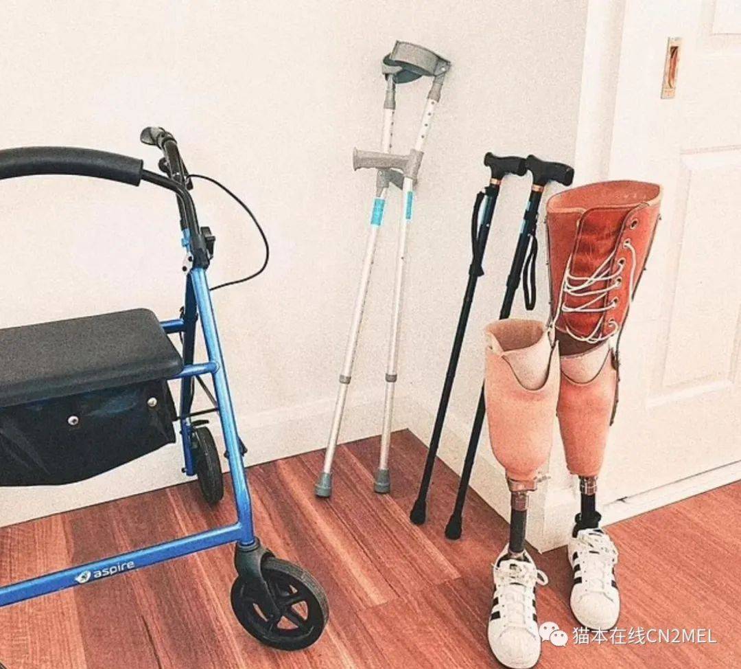澳洲郁抑症女孩自杀未果反致双腿截肢,然而勇敢的她"重生了"