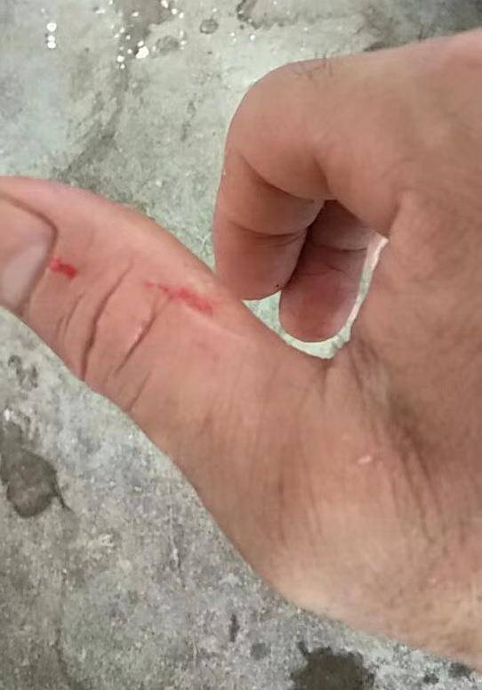 被猫狗抓伤咬伤是养殖户背后的辛酸