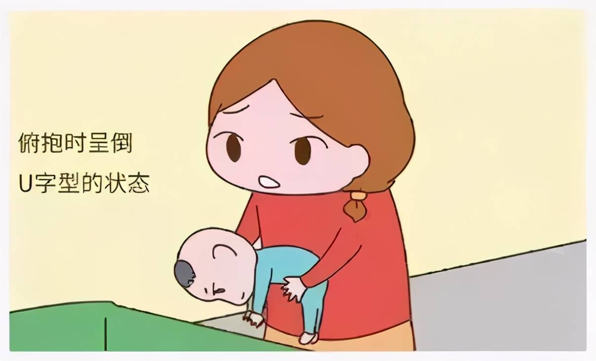 脑瘫患儿的几种症状表现,儿科医生:家长要提早认识并预防
