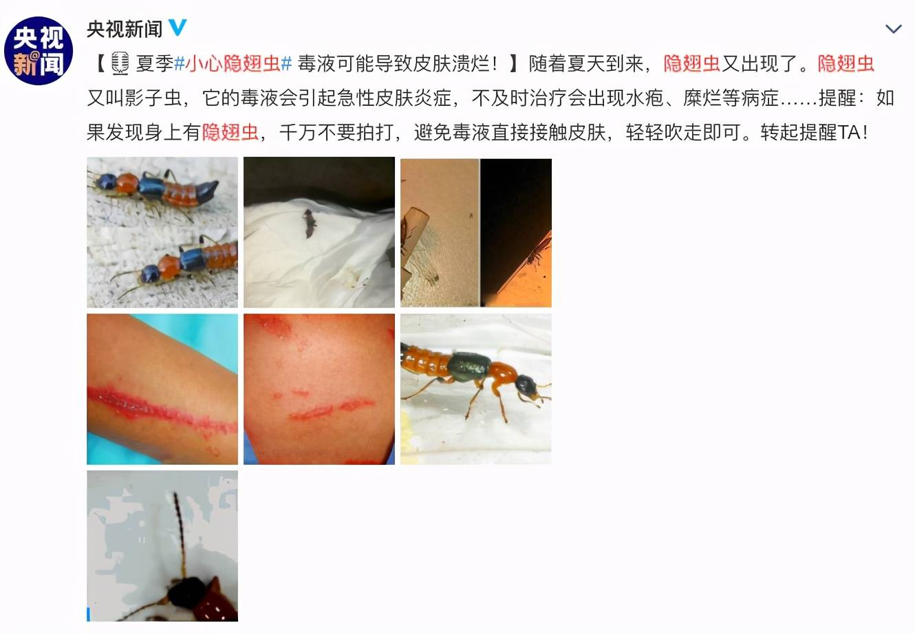 李李妈妈则是淡定地说到, 用嘴吹气把虫子吹走就好啦!