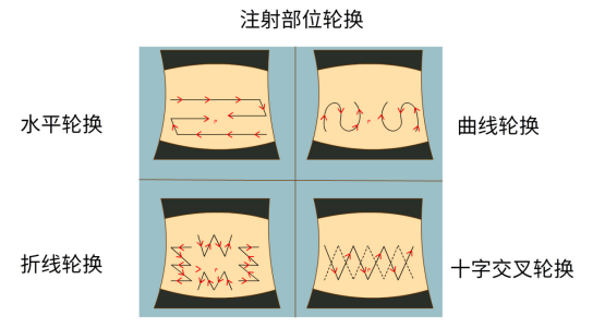 从放弃到继续,我的11年胰岛素注射经验