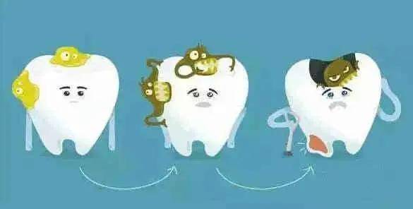口腔医生提醒你:偏侧咀嚼可不止是毁容_牙齿