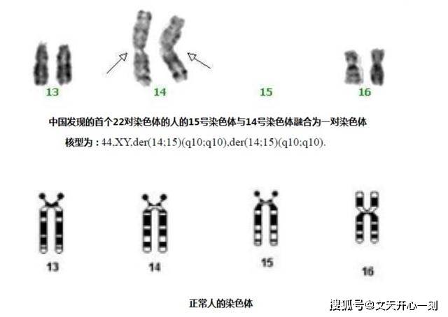 男性y染色体不断缩短,450万年后可能消失,到时还有男性吗?