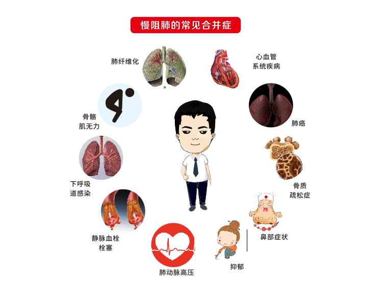 了解慢阻肺——关注呼吸健康,让生活的更精彩!