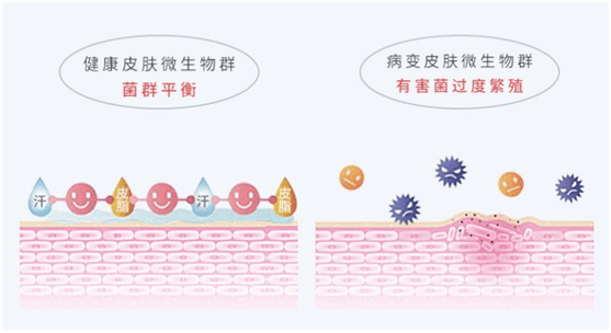 薇臻荟二裂酵母膜抛系列护肤原理:平衡,支持和保护皮肤微生物群