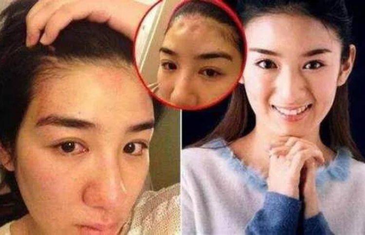 4位嫁入豪门被家暴的女明星,有的差点被毁容,有的终于