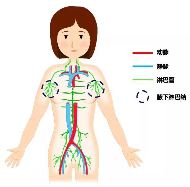 癌症术后并发症淋巴水肿上肢篇