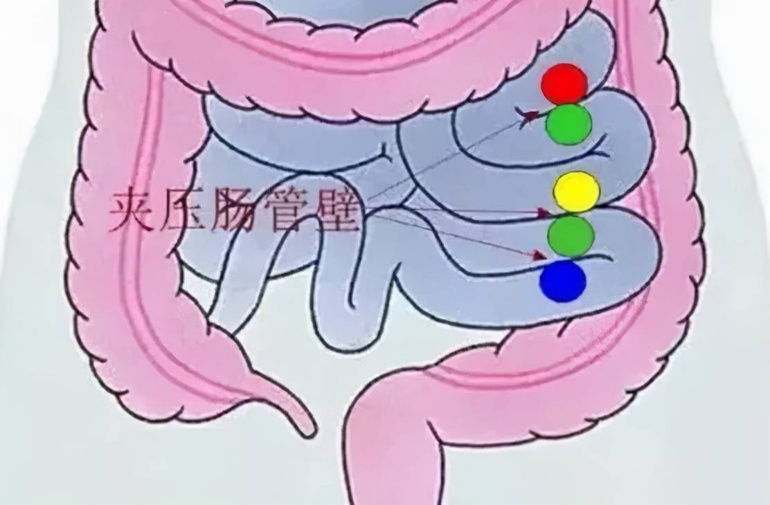 央视曝光益智玩具致多名儿童肠穿孔注意防范