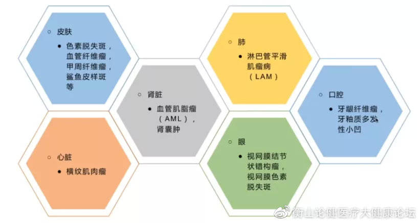 其他系统受累02●钙化●室管膜下巨细胞星形细胞瘤●室管膜下结节