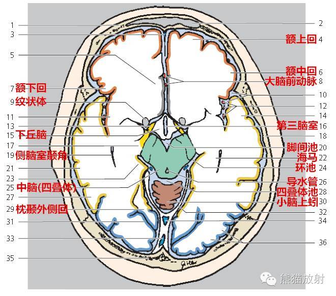 解剖颅脑ct断层中英文对照干货满满